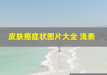 皮肤癌症状图片大全 浅表